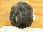 2008.11.12 頭頂部