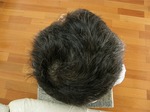 2008.12.13 頭頂部