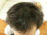 2008.12.13 前頭部