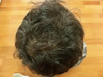 2009.01.20頭頂部