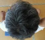 頭頂部写真-20130708