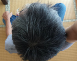 頭頂部写真-20130904
