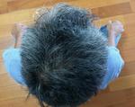 頭部写真-20131003.jpg