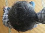 頭頂部写真20131204