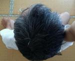 頭頂部写真-20130803.jpg