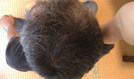 頭部写真-20130515