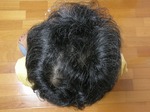 2010.05.29頭頂部