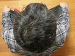 20110317頭頂部