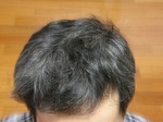 20110317前頭部